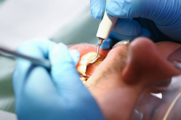 Best Pediatric Emergency Dentist in Heron Bay, GA