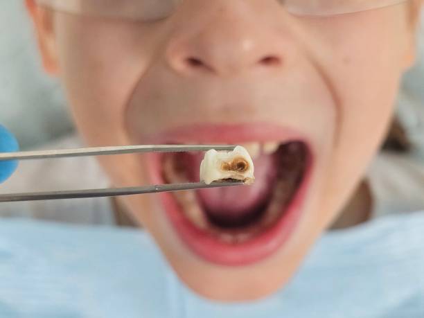 Best Orthodontic Emergency Dentist in Heron Bay, GA